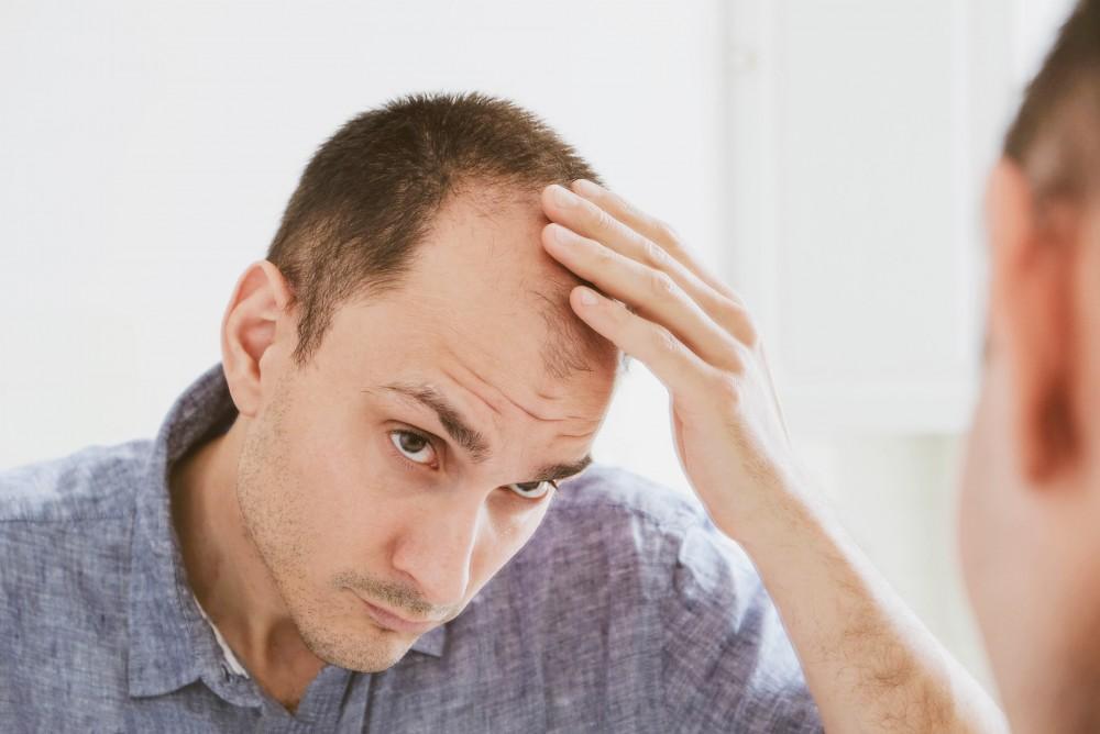 Is Hair Restoration The Best Treatment For Pattern Baldness?